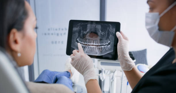 Licensed Tooth Extraction service in San Joaquin, CA - Smile Center Dentistry